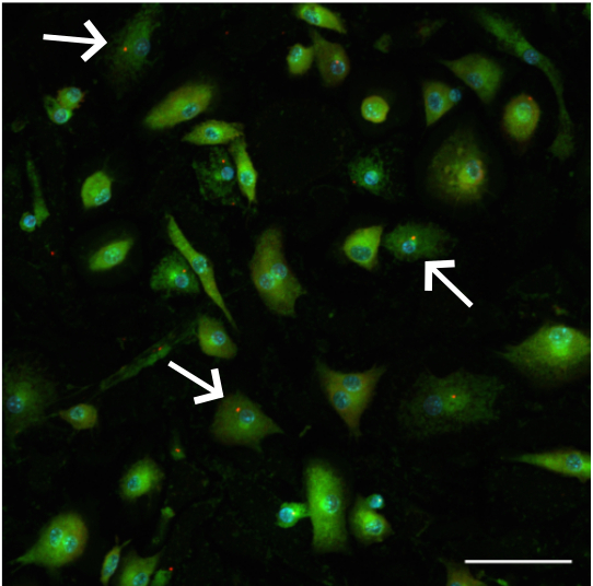 Inflammasomes in Infections and Auto-inflammation laboratory