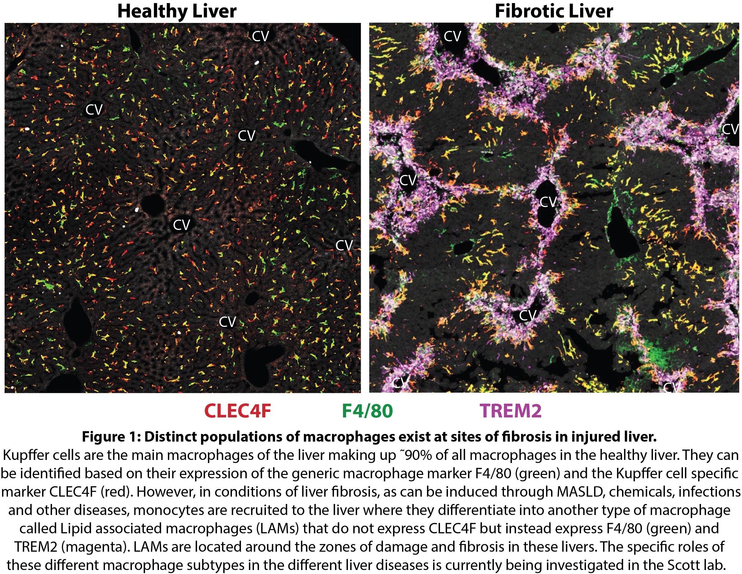 Lab of Myeloid Cell Biology in Tissue Damage and Inflammation