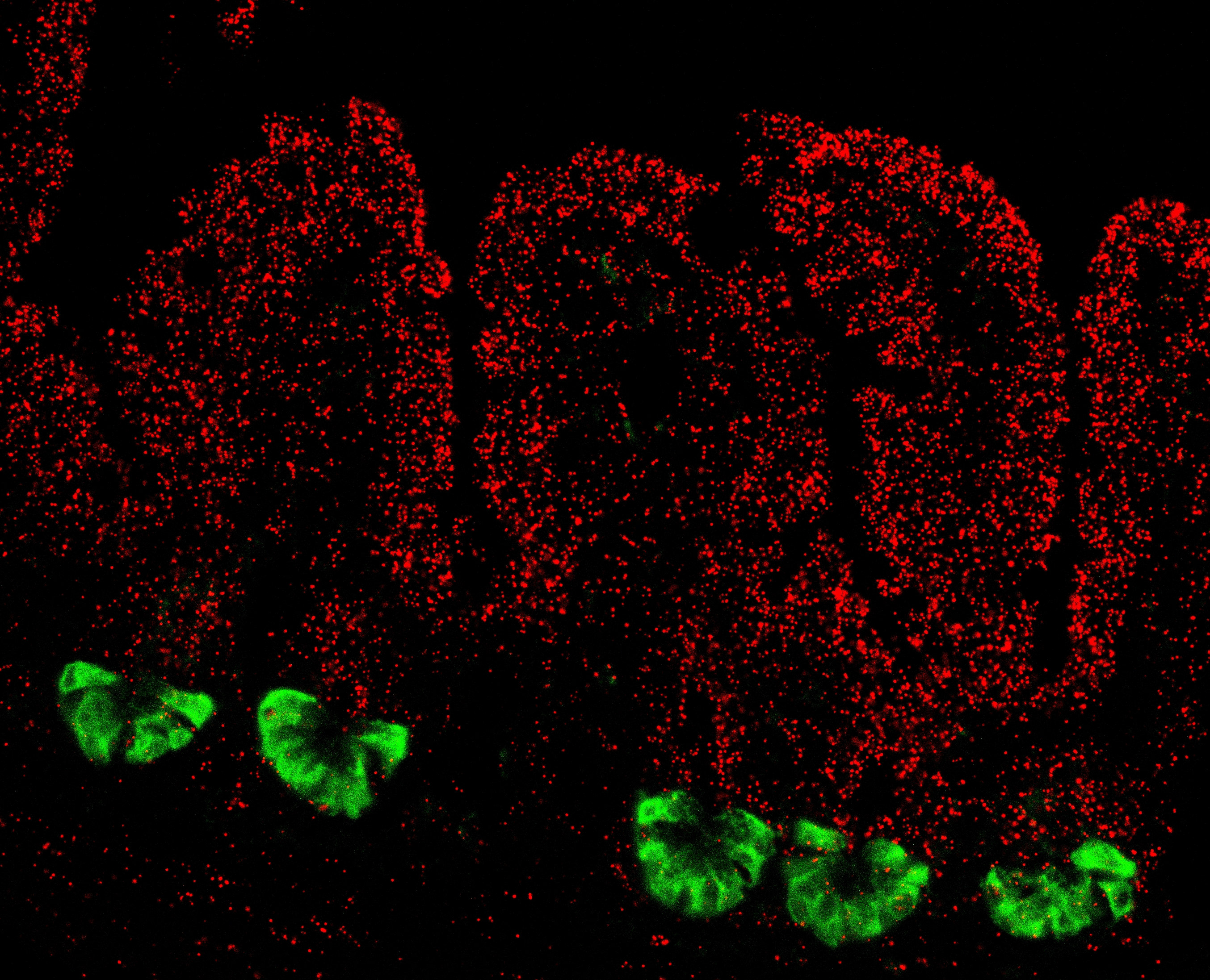Mouse Genetics and Inflammation