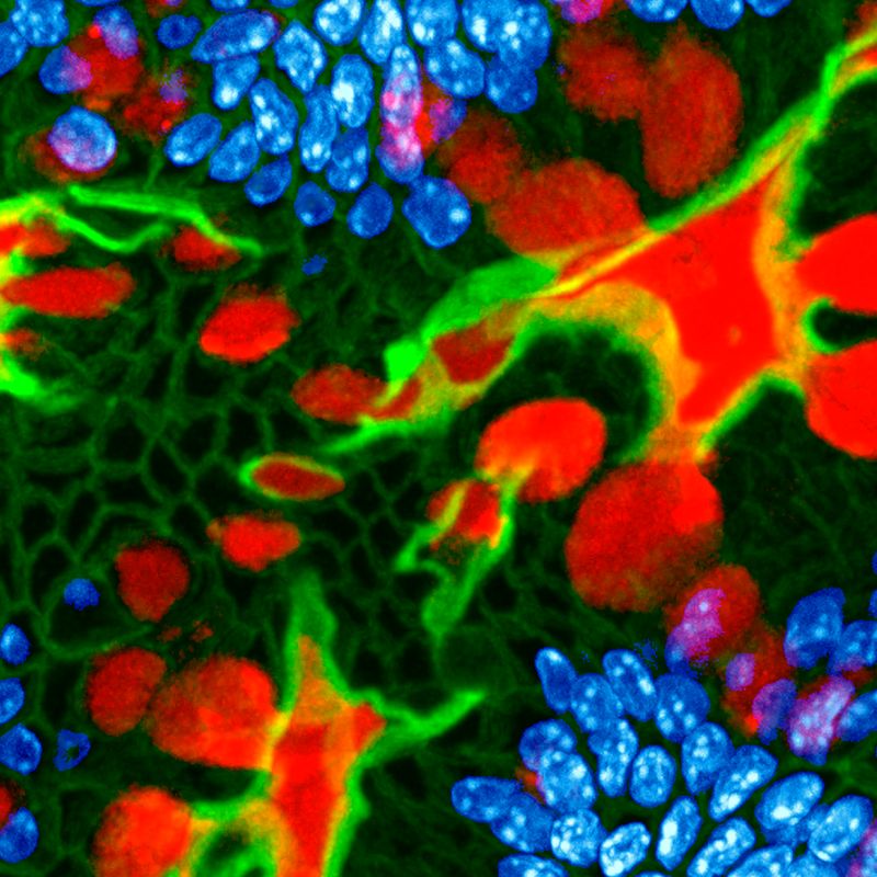 Mucins in health and disease