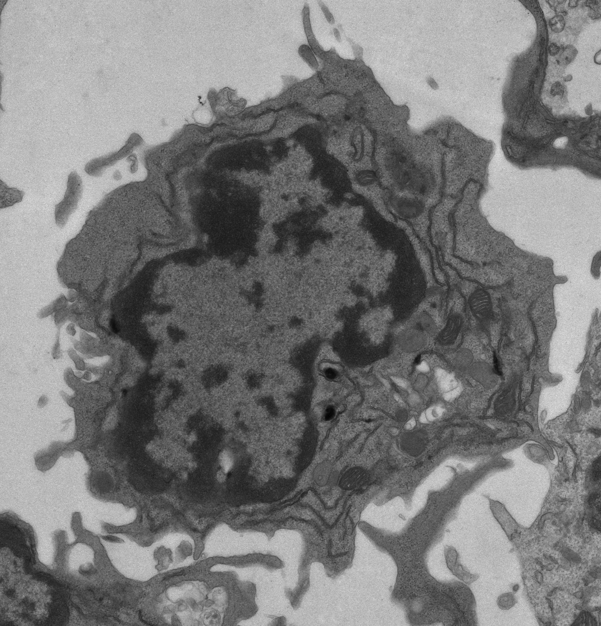 Laboratory for ER Stress and Inflammation