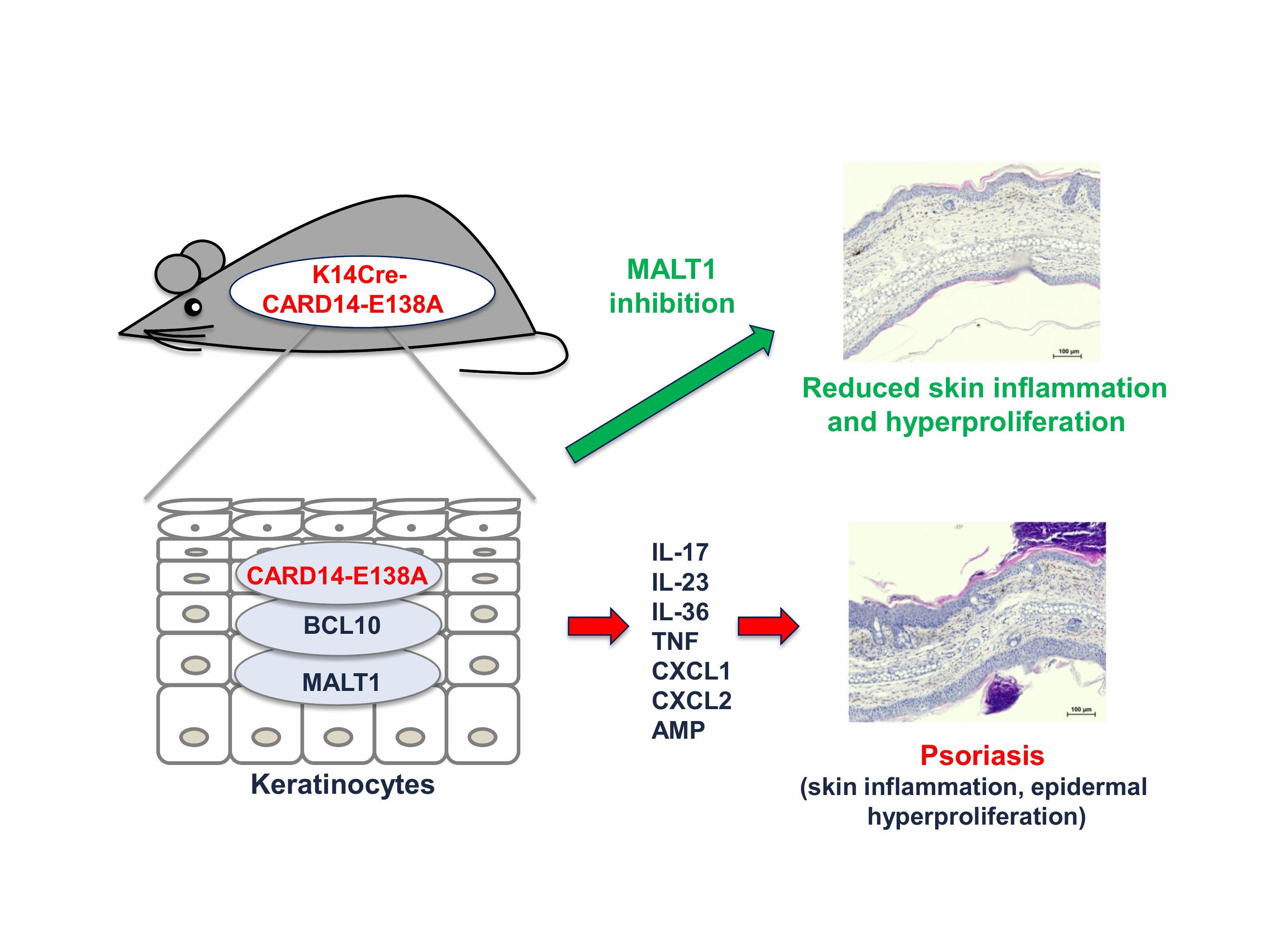 Unit of Molecular Signal Transduction in Inflammation