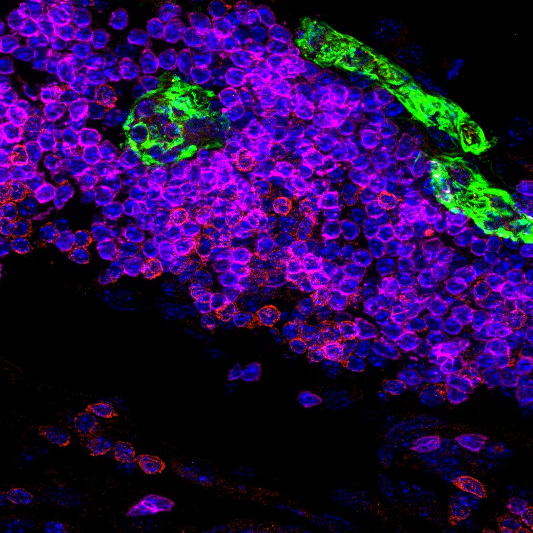 Immune Niches in Cancer & Inflammation (Organized in partnership with Cell Press)