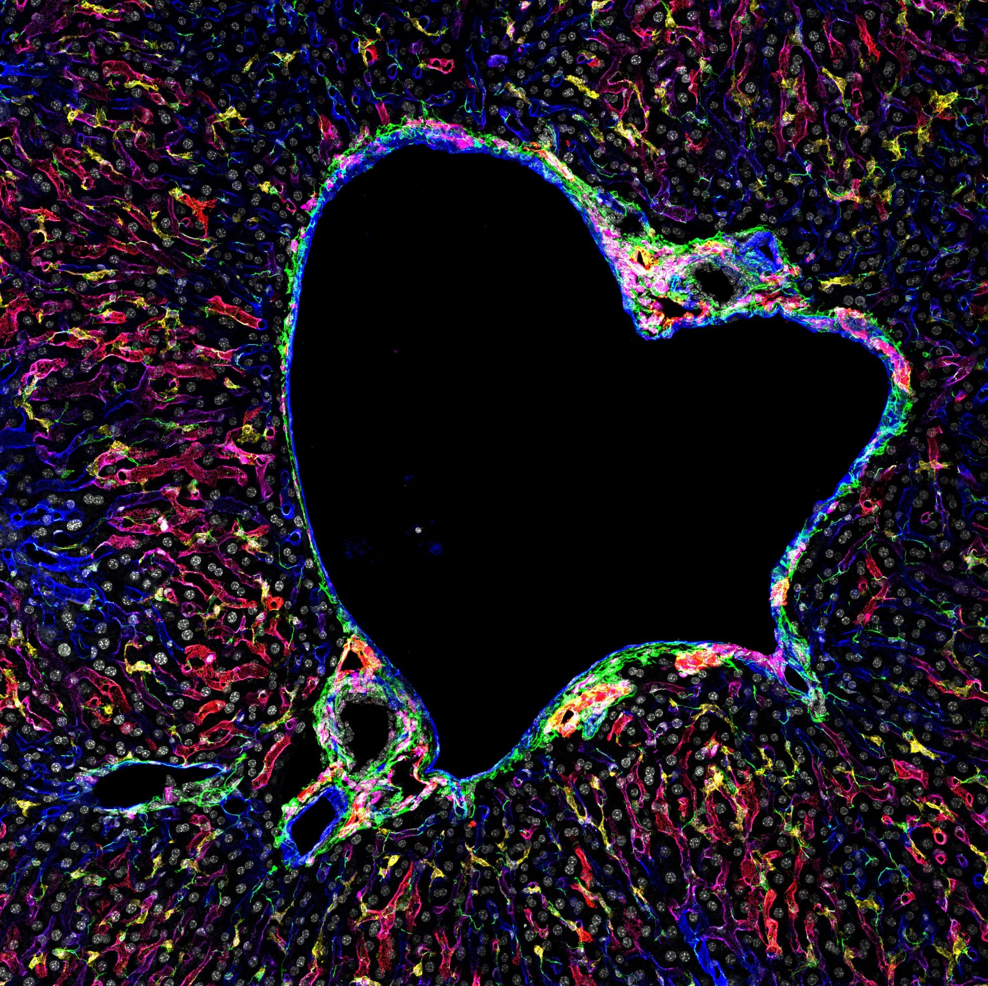 icroscopy highlighting the heterogeneity of myeloid, endothelial and mesenchymal cell subsets in the liver.icroscopy highlighting the heterogeneity of myeloid, endothelial and mesenchymal cell subsets in the liver.  Credits: Johnny Bonnardel & Martin Guilliams.