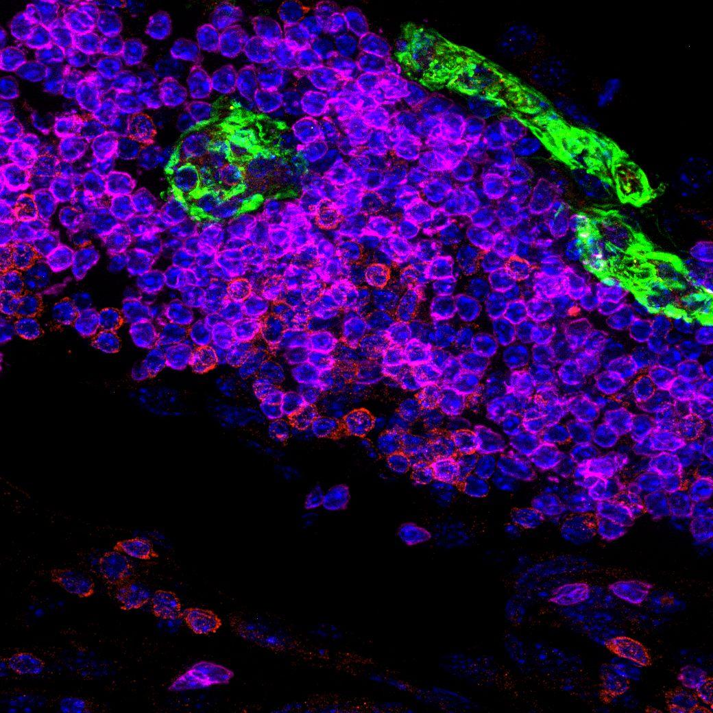 Immune Niches in Cancer & Inflammation (Organized in partnership with Cell Press)