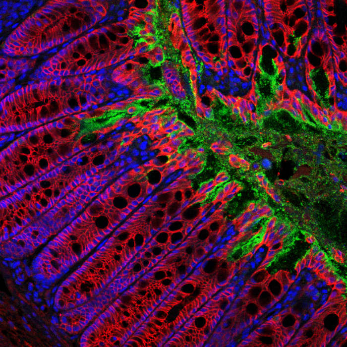 Investigating the role of gastrointestinal inflammasome responses during infection and autoinflammation
